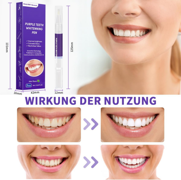 Zahnaufhellung Bleaching Stift, Purple Teeth Whitening Pen, Zähne Aufhellen, Schnelles Entfernen Aller Flecken, Zahnbleaching (3 Stück) - Image 5
