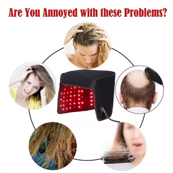 LED Red Light Therapy Hat for Hair Growth Red & Infrared Light Hair Growth Cap for Hair Loss Promote Hair Fast Regrow Care Cap - Image 7